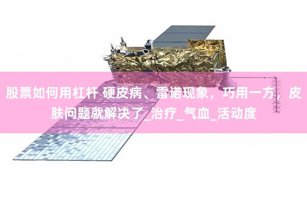 股票如何用杠杆 硬皮病、雷诺现象，巧用一方，皮肤问题就解决了_治疗_气血_活动度